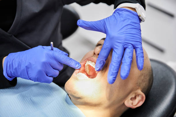Best Knocked-Out Tooth Emergency  in San Anselmo, CA