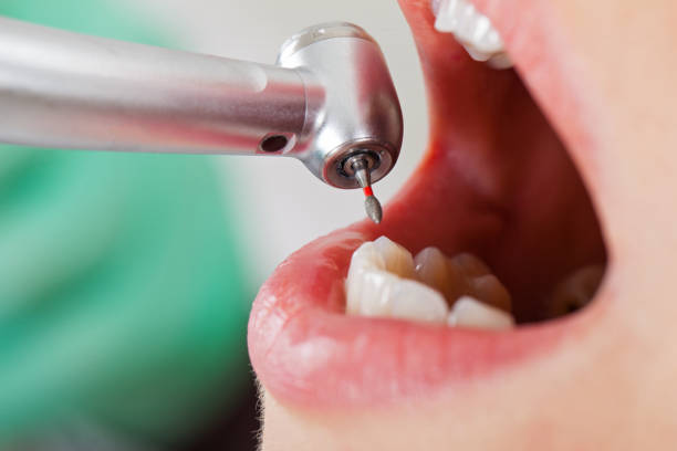 Best 24-Hour Emergency Dentist  in San Anselmo, CA
